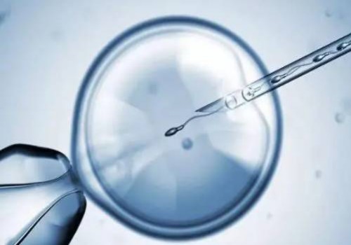 难孕难育女性患有多囊卵巢考虑试管婴儿就可以成功了吗-